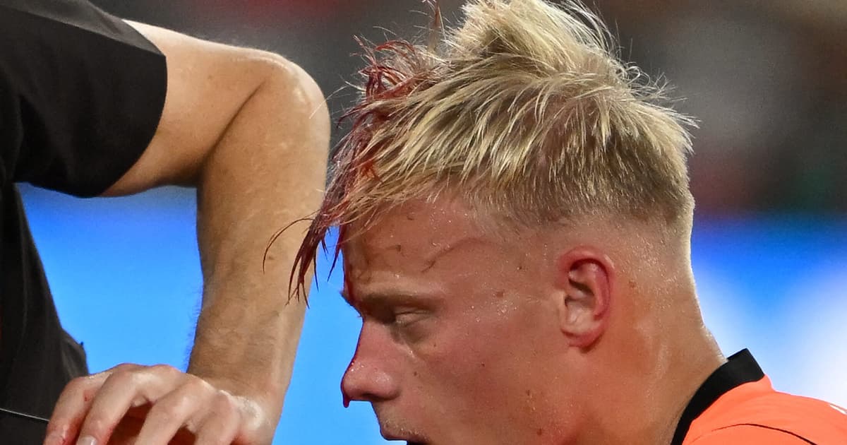 holanda tem copa do mundo: o detalhe que mais repercutiu