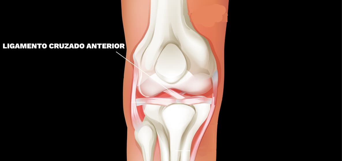 Ilustracao-do-ligamento-cruzado-anterior-do-joelho-vale-esse