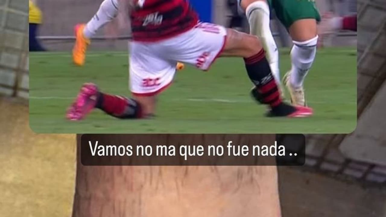 Meia do Flamengo ironiza VAR ao publicar foto do tornozelo lesionado.