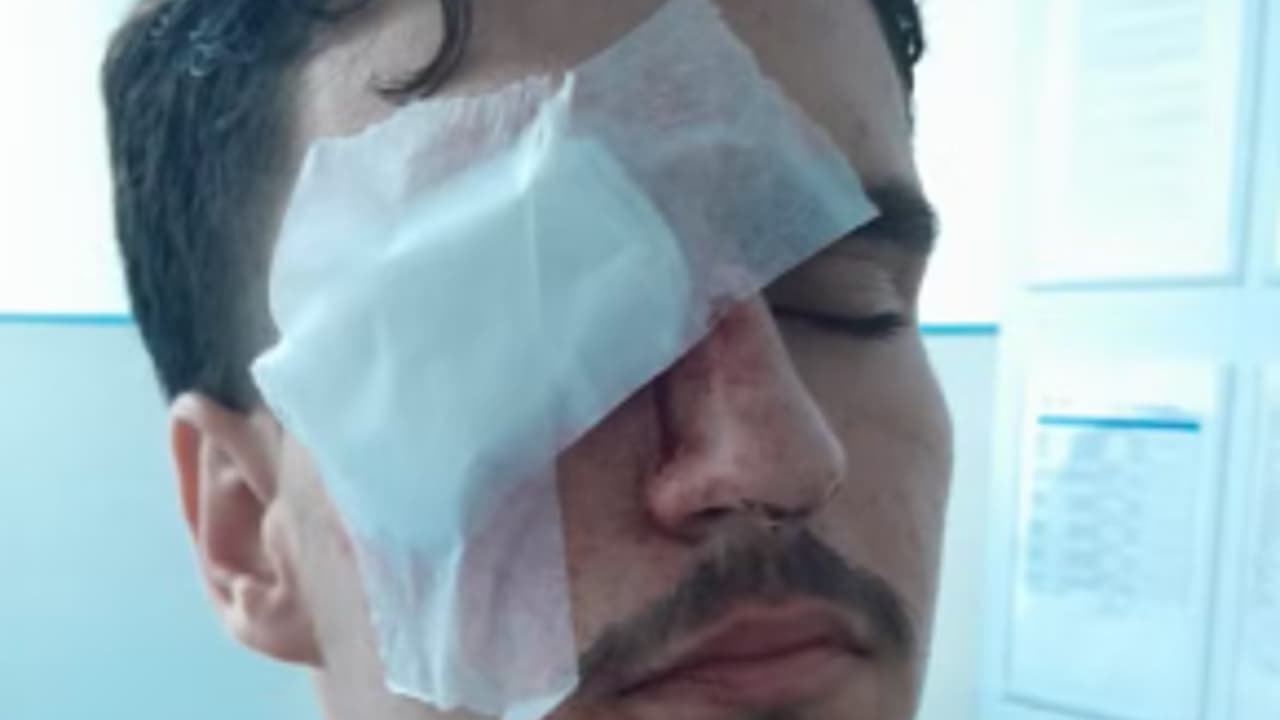 Estudante vascaíno de 18 anos acusa PM após perder visão em olho com bala de borracha no Maracanã — Futebol
