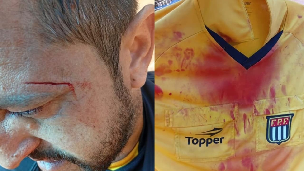 Escândalo no futebol infantil: árbitro é espancado por pais e atletas em Catanduva — Futebol