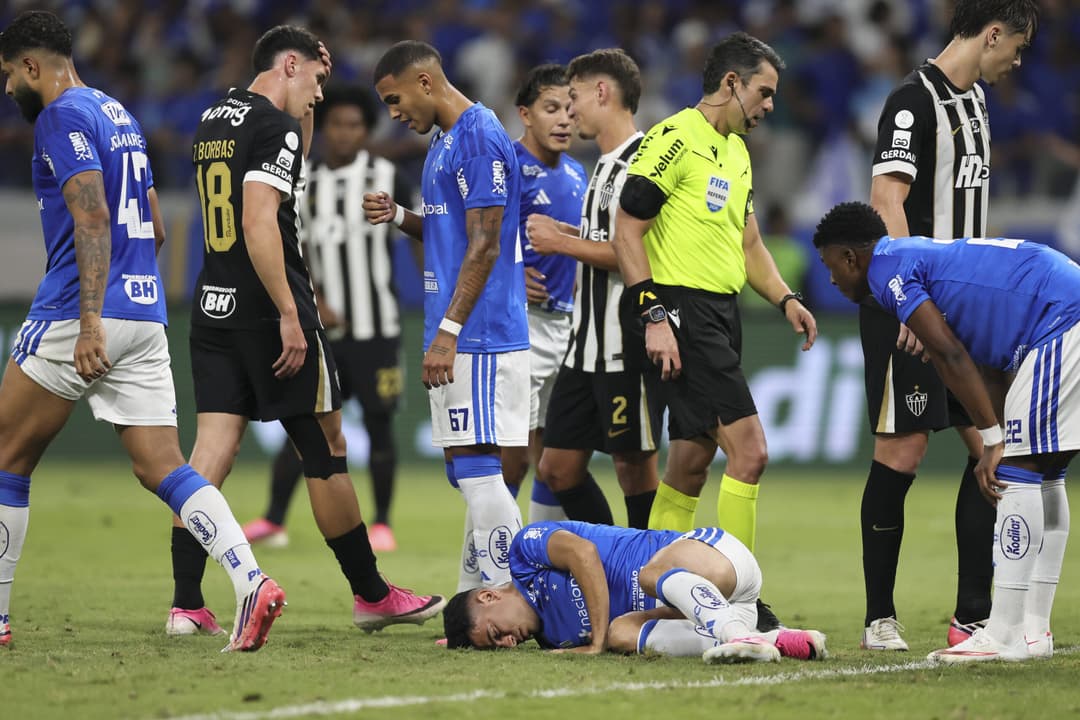 Cruzeiro Bruno Rodrigues Tem Fratura No Osso Zigomatico E Na Costela.html