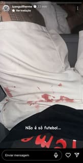 Luan-Sangue-Corinthians_Easy-Resize.com