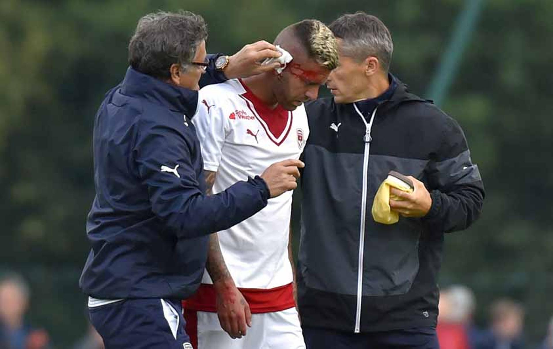 Ménez perde parte da orelha em jogo do Bordeaux