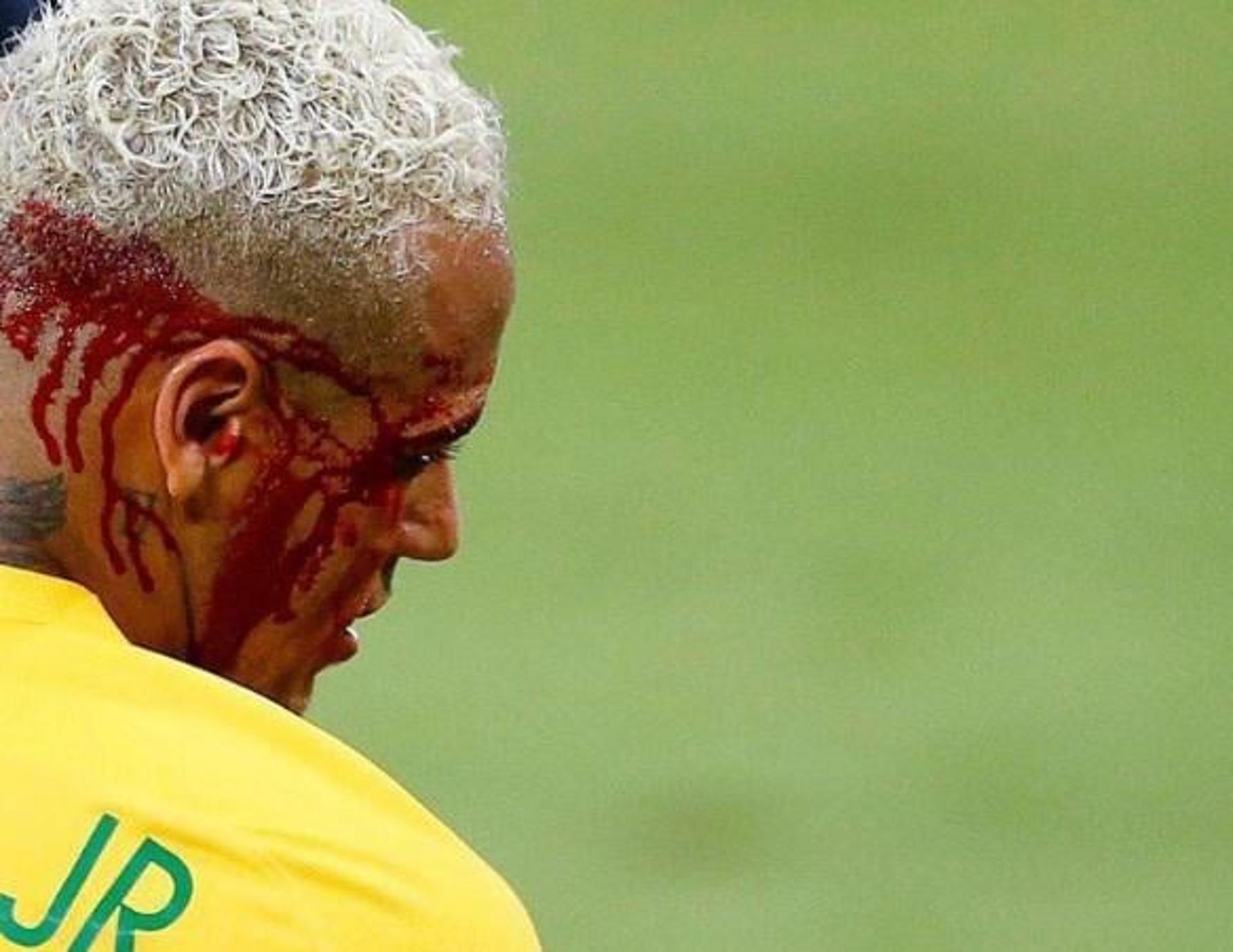 Neymar levou cotovelada no jogo contra Bolívia