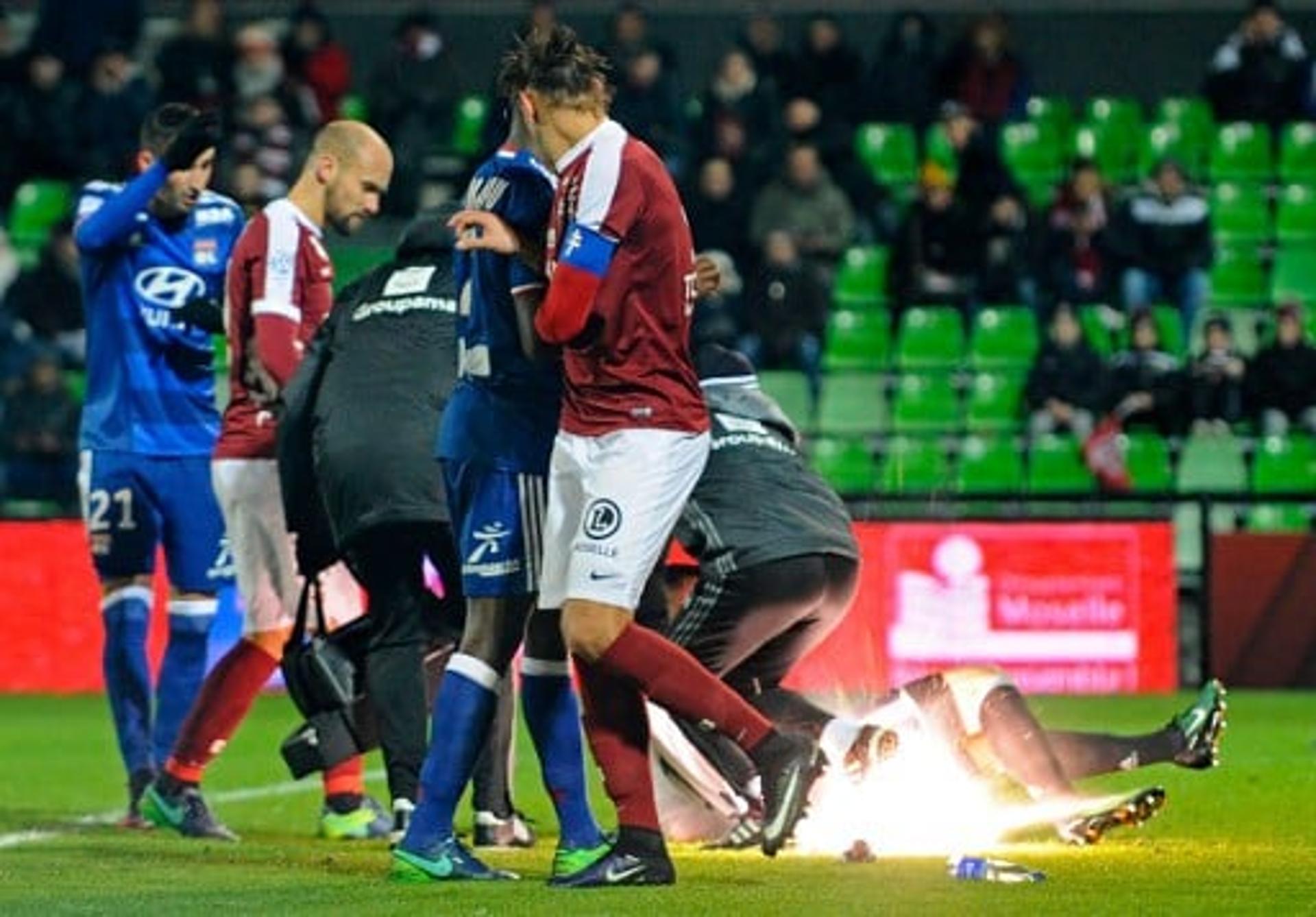 Anthony Lopes - Metz x Lyon