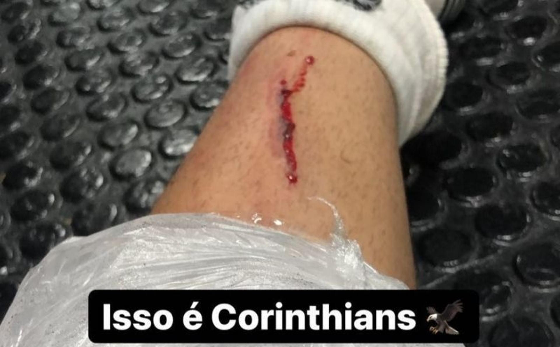 Roni sofreu entrada violenta de Thiago Heleno