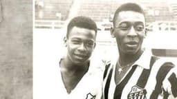 Zoca e Pelé