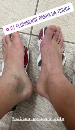 Yago publicou foto de tornozelo lesionado após jogo contra o Atlético-MG