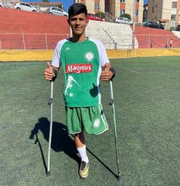 Gabriel Lucas não desistiu do futebol apesar da perna ter sido amputada por uma linha chilena, que é proibida