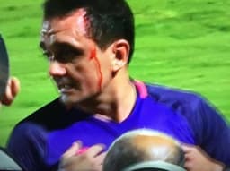 Árbitro Bruno Rodríguez após agressão no futebol uruguaio