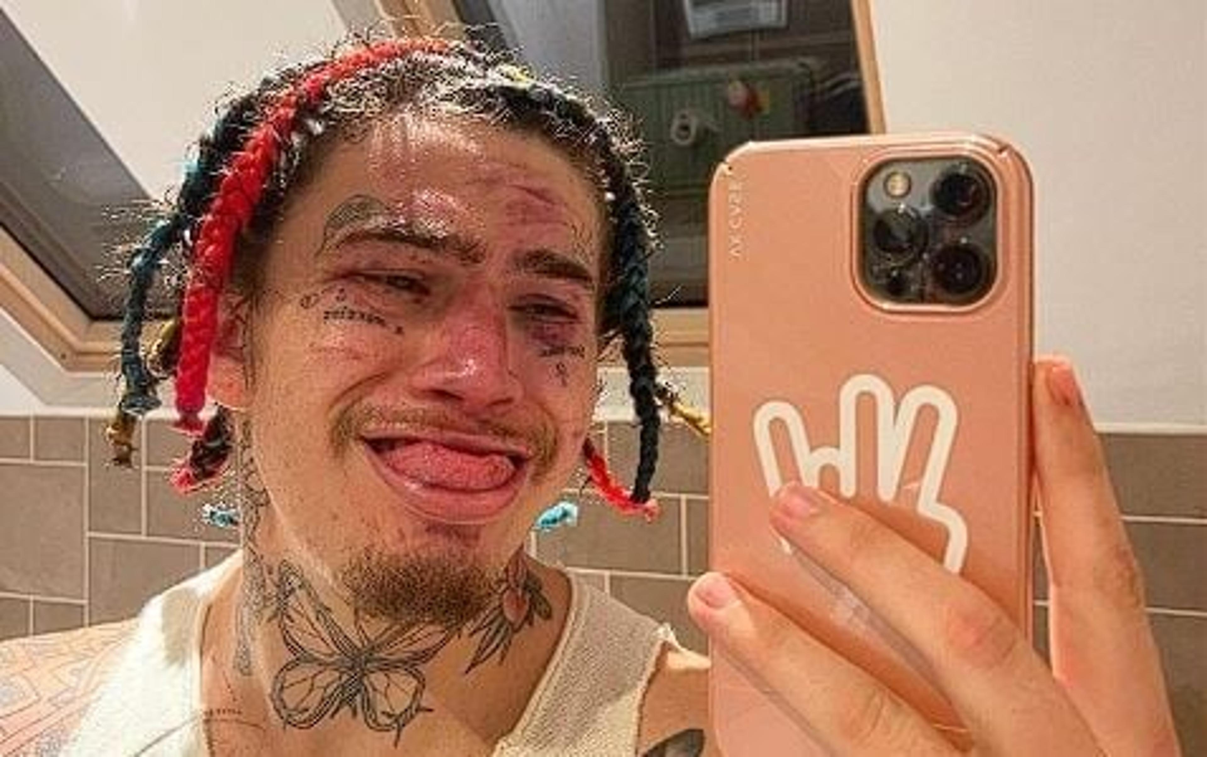 ‘Caiu de moto?’: Whindersson Nunes recebe mensagens de amigos no Instagram após derrota em luta