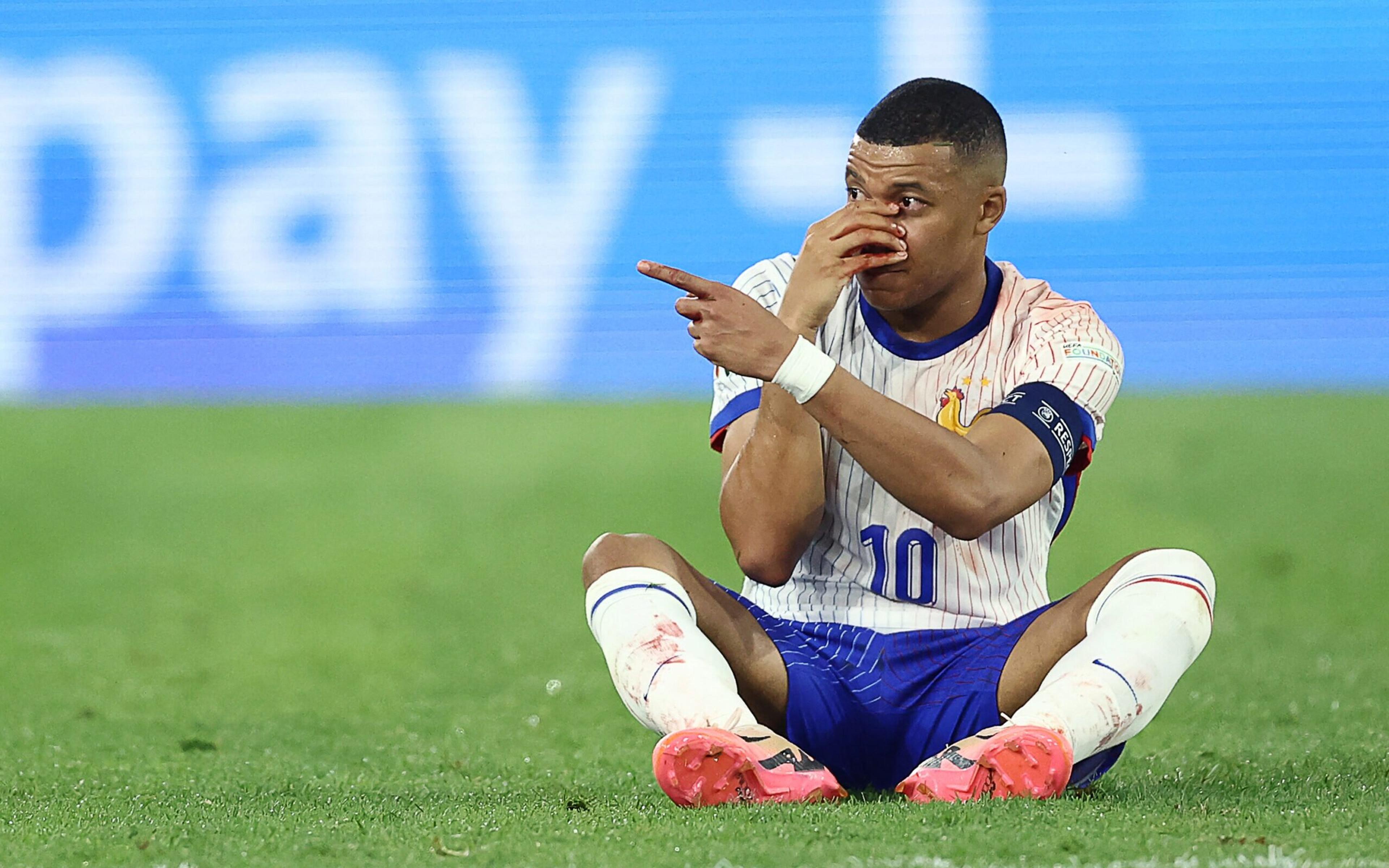 Mbappé desfalca França diante da Holanda na Eurocopa por fratura no nariz