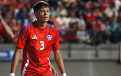 Zagueiro do Atlético-MG passará por cirurgia após fratura na seleção