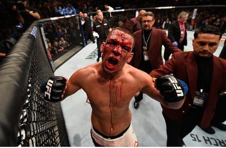 Diaz
