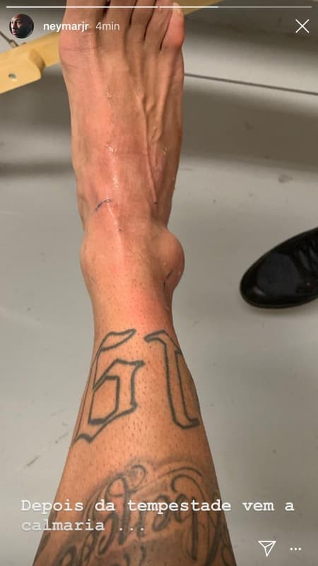 Neymar - tornozelo inchado