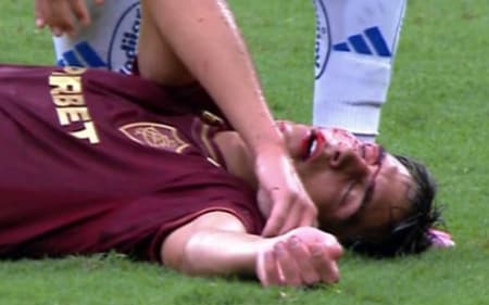 Bernal é atingido por Matheus Pereira em Cruzeiro x Fluminense