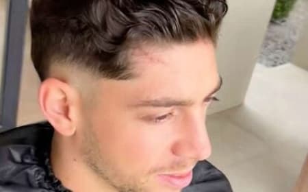 Valverde com cicatriz na testa.