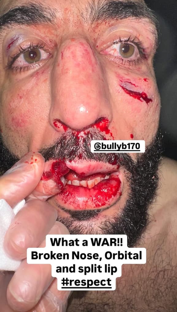 belal-muhammad-ufc-315