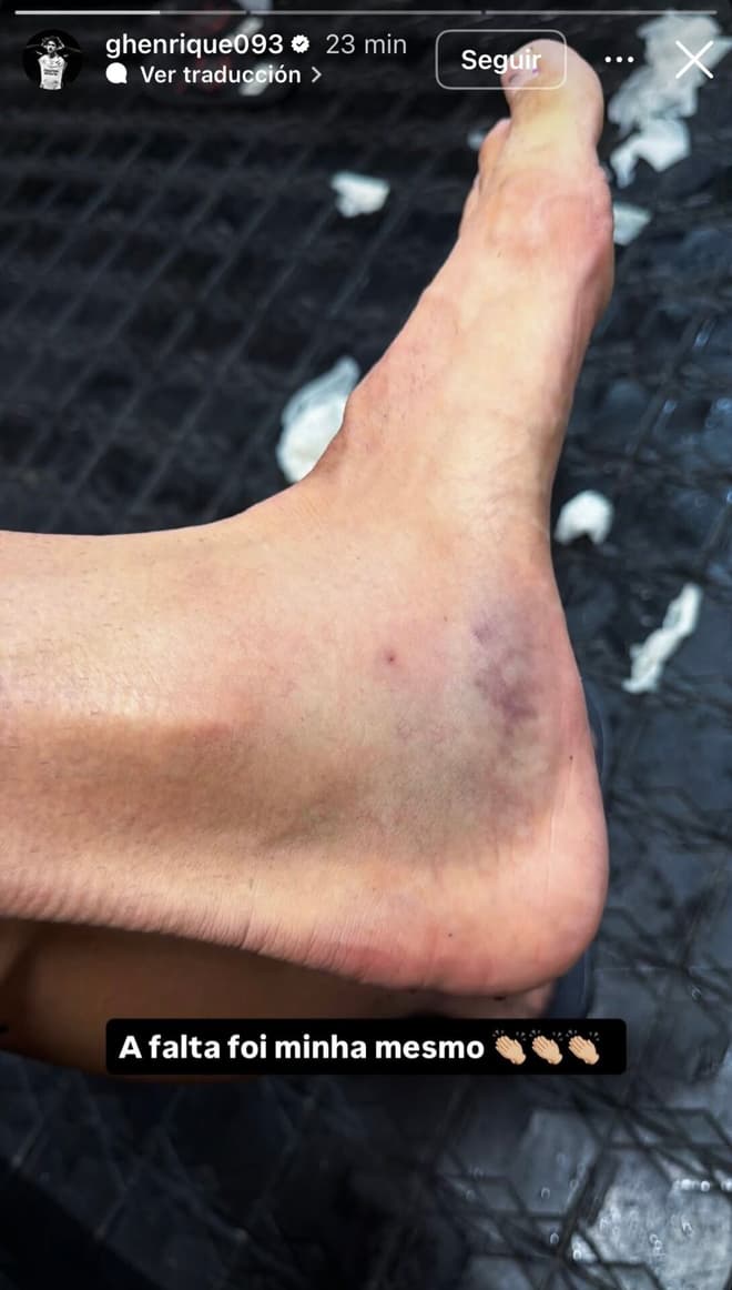 pé de Gustavo Henrique, do Corinthians