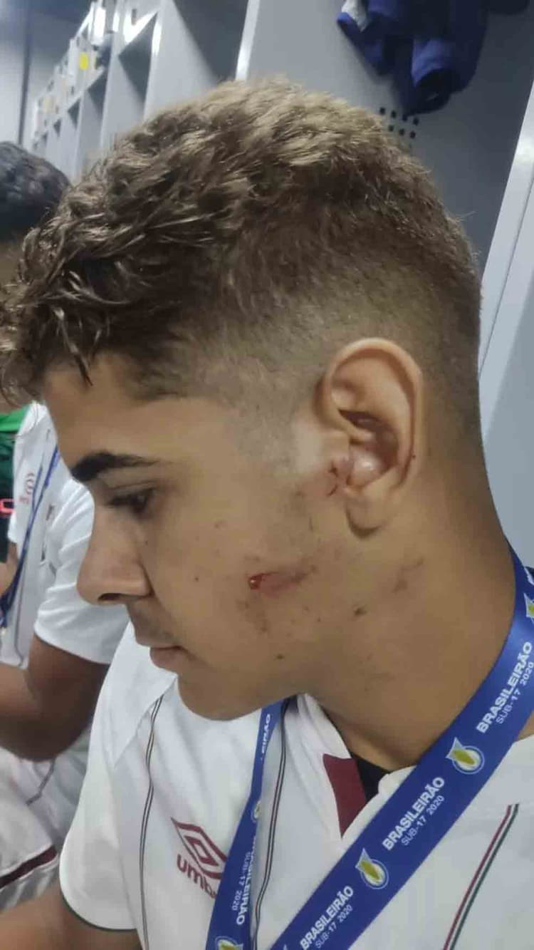Jogador ferido - Fluminense x Athletico-PR