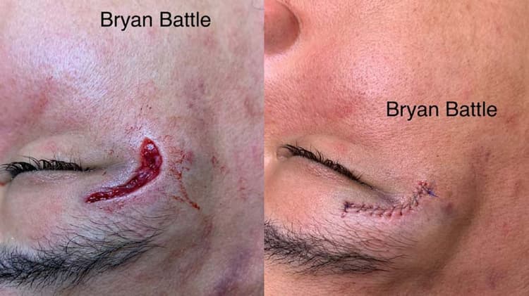 Bryan Battle