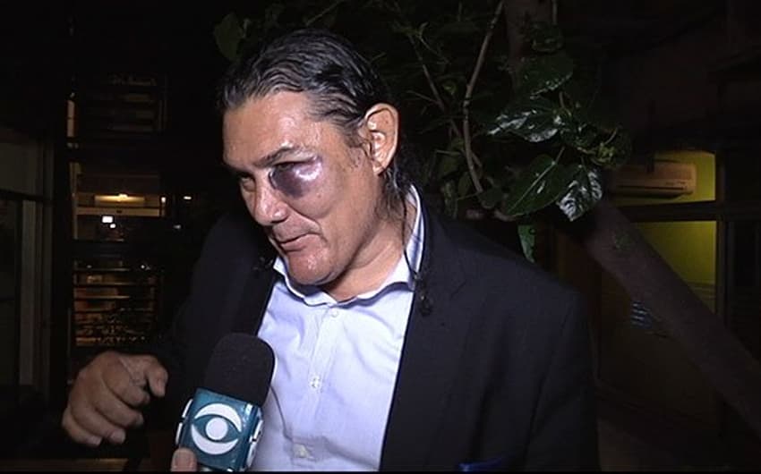 Funcionário da Venezuela aparece com olho roxo