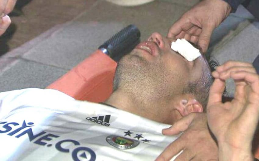 Van Persie na partida entre Fenerbahçe e Akhisar Belediye Genclik, neste domingo. Atacante sofreu uma lesão no olho!