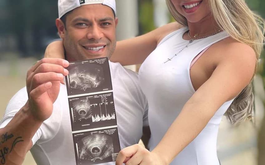 Hulk e Camila anunciam gravidez
