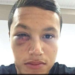 Marlon posta foto após lesão sofrida no jogo contra o Goiás, pela Série B (Foto: Reprodução)