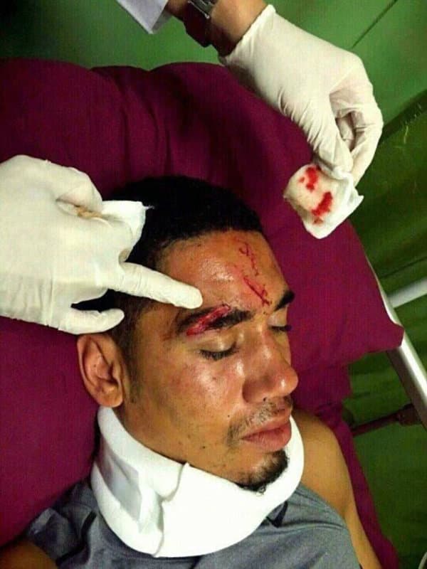 Smalling envenenado