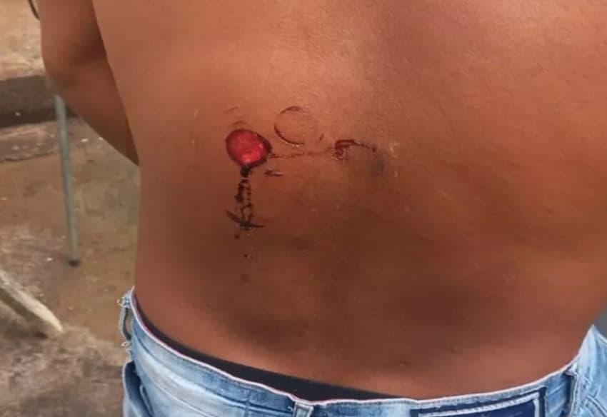 Homem é alvejado com bala de borracha dentro de estádio