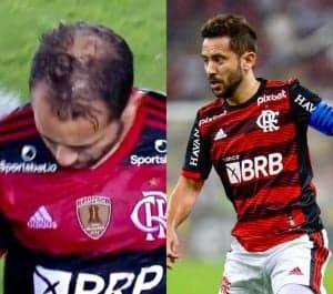 Everton Ribeiro