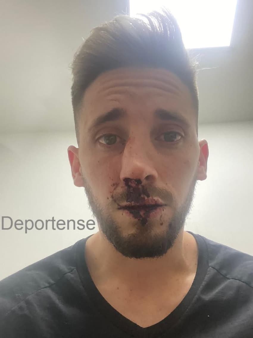 Jogador-Nicolas-e-agredido-durante-briga-de-torcidas-na-Argentina