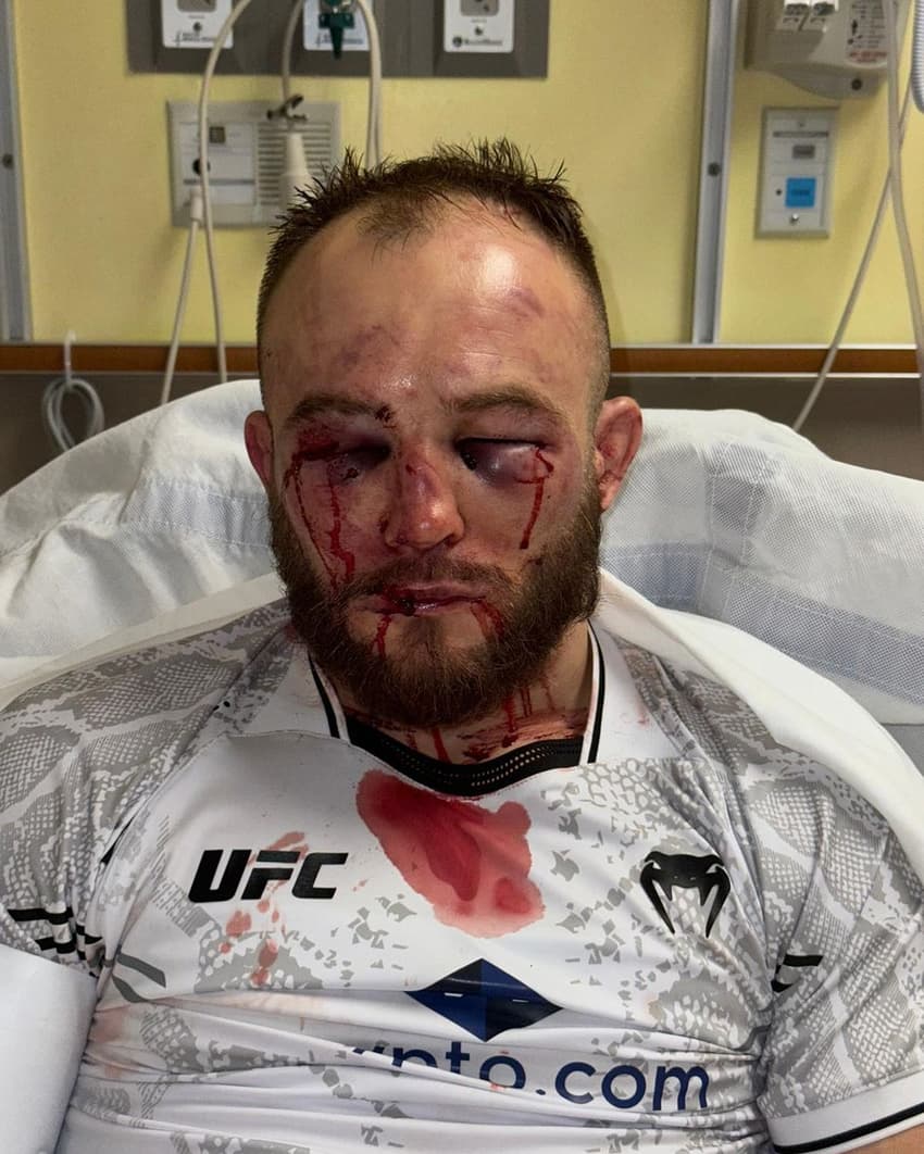 UFC