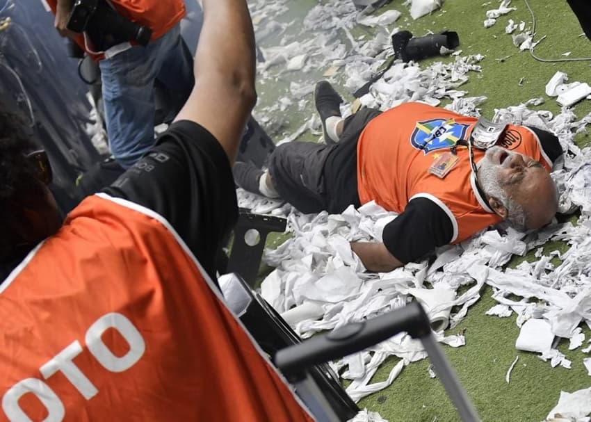 O fotógrafo Nuremberg José Maria, de 67 anos, foi atingido por uma bomba na Arena MRV e precisou passar por cirurgia (Foto: Dhavid Normando/Folhapress)