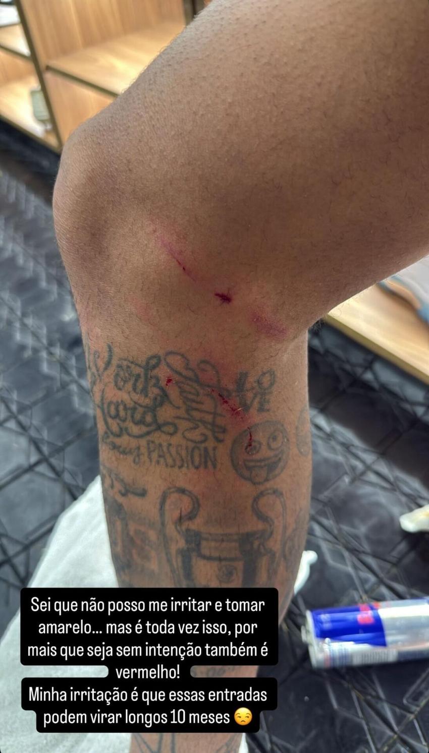 Neymar faz post nas redes sociais reclamando da arbitragem. (Foto: Divulgação/ Instagram)