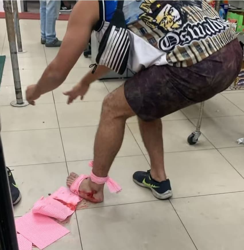 Torcedor do Vasco levou tiro no pé (Foto: Reprodução)