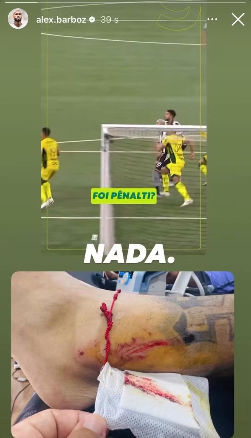 barboza-botafogo-machucado-mirassol