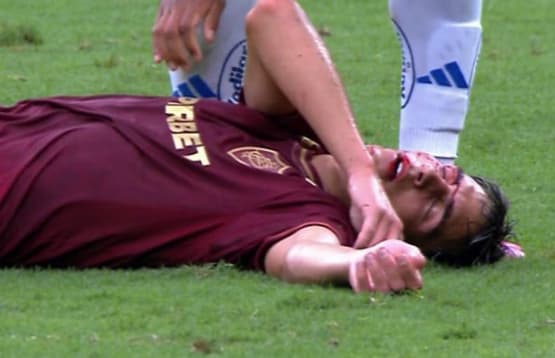 Bernal é atingido por Matheus Pereira em Cruzeiro x Fluminense