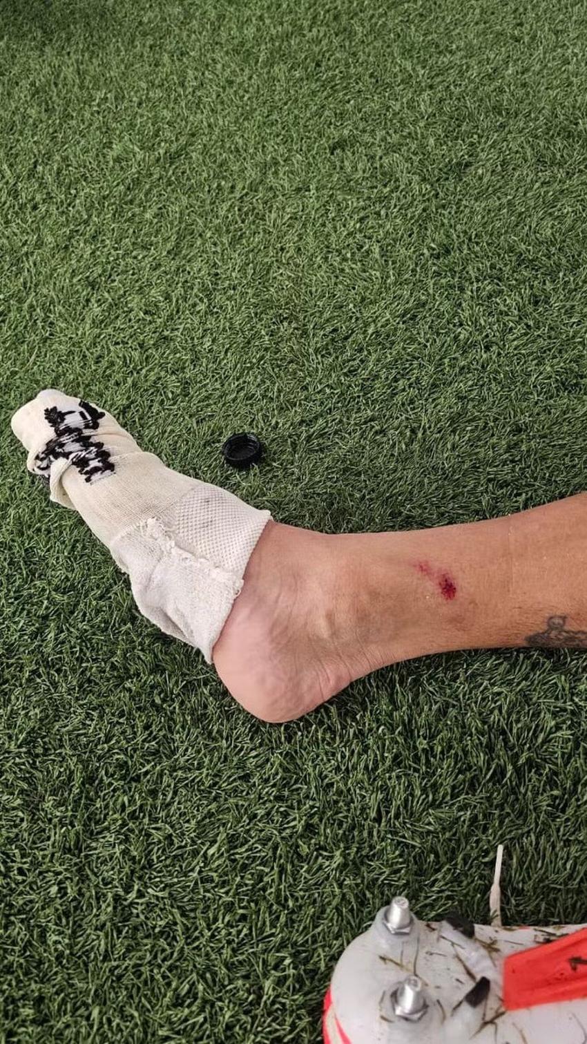 Canobbio, do Fluminense, sofreu entrada dura de Allan (Foto: Reprodução)