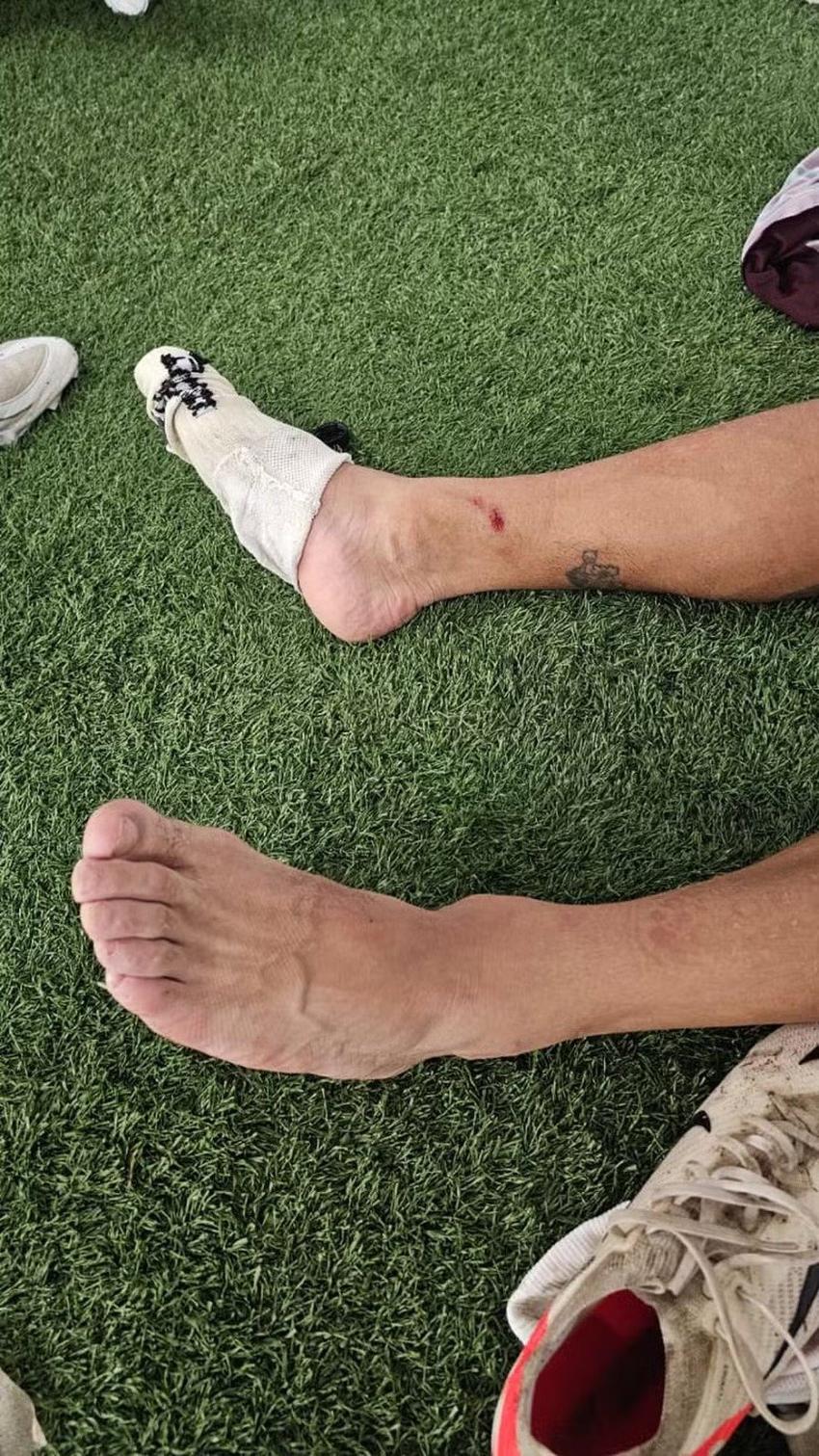 Canobbio, do Fluminense, sofreu entrada dura de Allan (Foto: Reprodução)