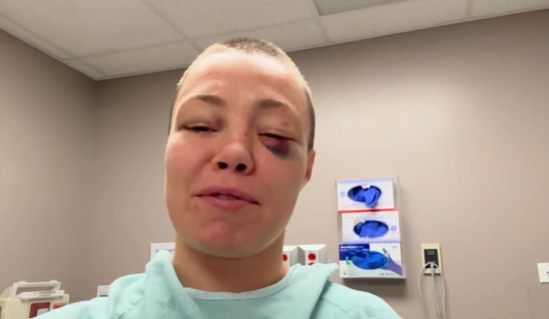 Namajunas após o UFC 324 e antes da cirurgia (Reprodução Instagram rosenamajunas)