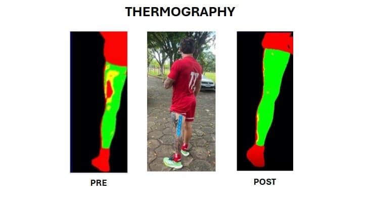 portuguesa canabidiol