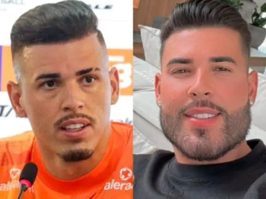 Harmonização facial de Ivan, goleiro do Remo (Foto: Reprodução)