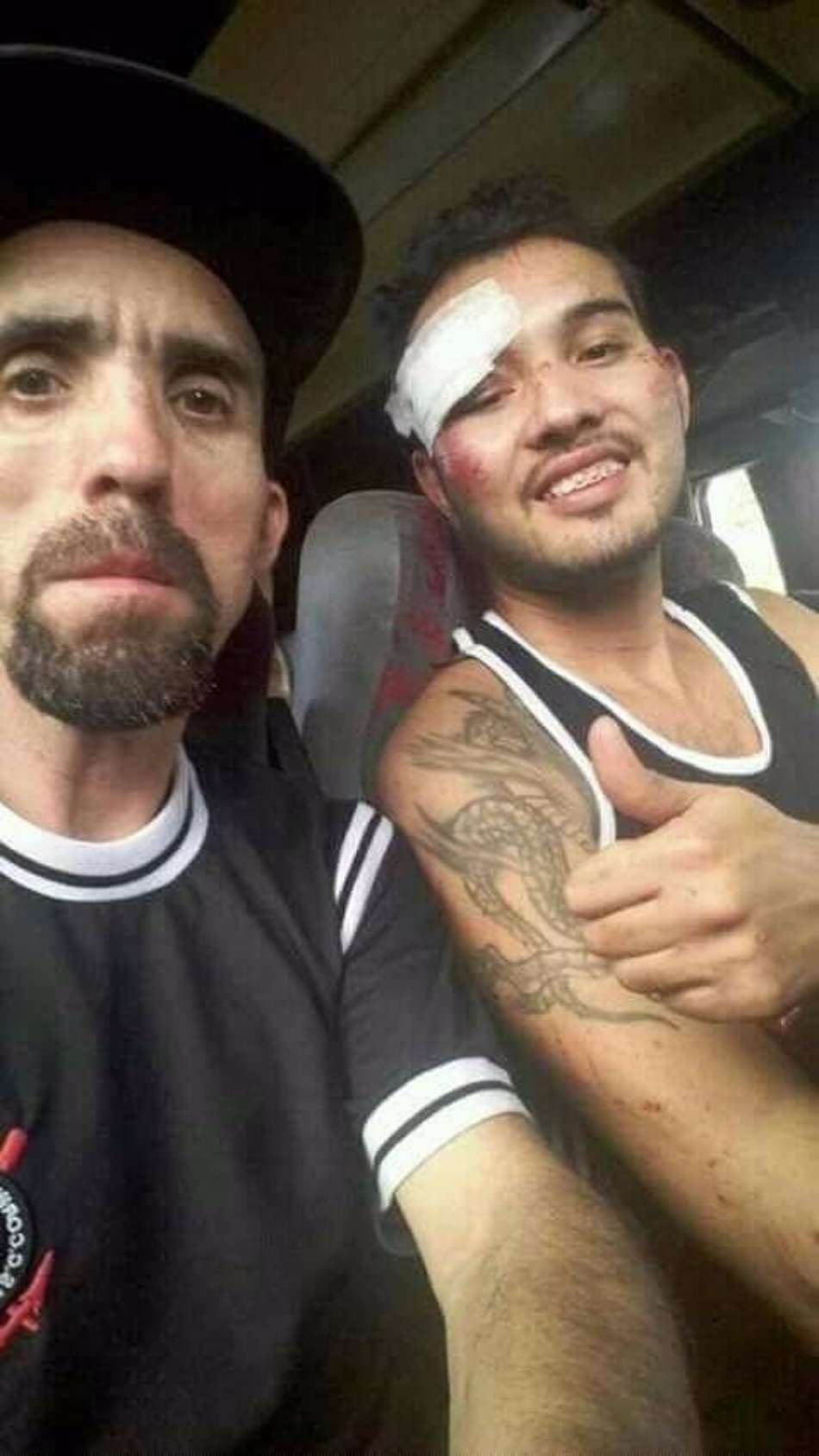 Torcedor agredido no Couto Pereira tem alta e aparece sorrindo em foto