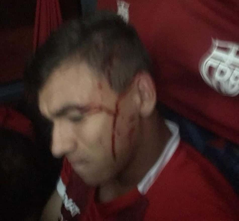 Jogadores do CRB desabafam após ataque ao ônibus