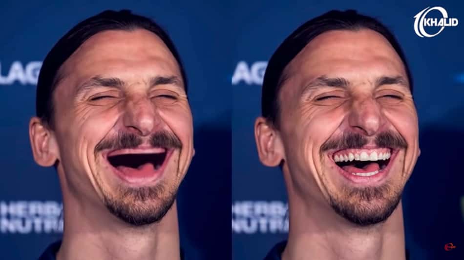 Banguelas? Brincadeira mostra os jogadores de futebol sem os dentes