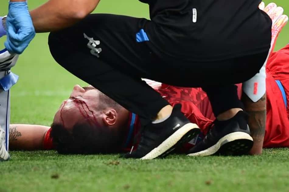 No Napoli, David Ospina vira preocupação após duro choque de cabeça
