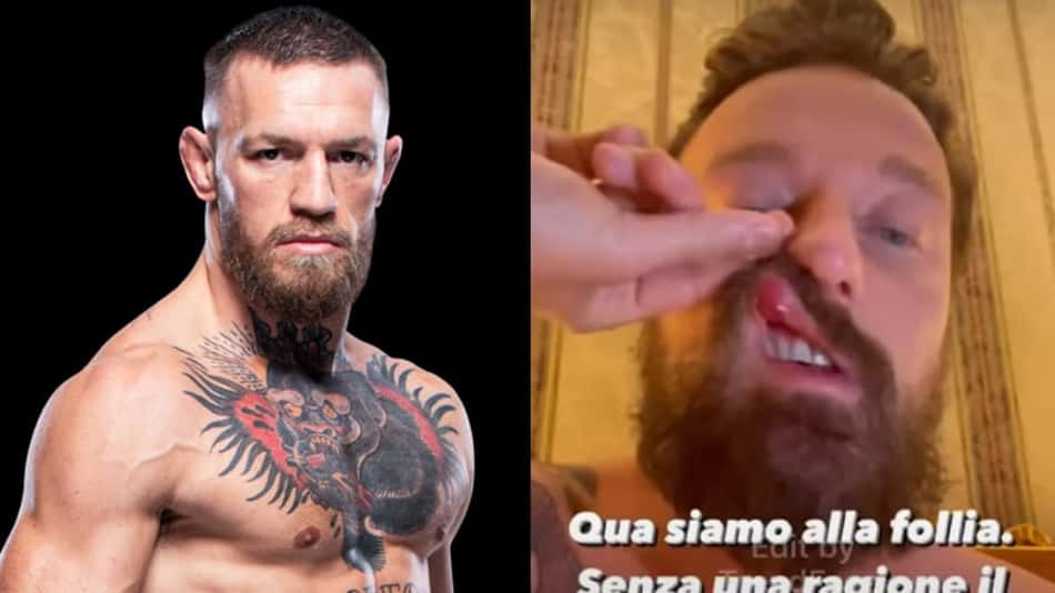 DJ italiano publica vídeo com marcas de uma suposta agressão de Conor McGregor: 'Violento e perigoso'